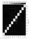 Fig. 11 - Automated Classification of Cells in Biologic Mixtures Analyzed by High Parameter Cytometry Instrumentation, Processing, System and Method