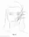 Fig. 02 - Facial structural shaping
