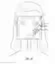 Fig. 03 - FACIAL STRUCTURAL SHAPING