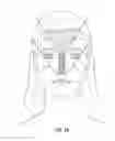 Fig. 10 - FACIAL STRUCTURAL SHAPING