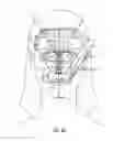 Fig. 12 - FACIAL STRUCTURAL SHAPING