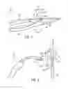 Fig. 08 - System and method of arranging welding device markers