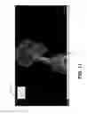 Fig. 33 - Method for segmentation of the head-neck arteries, brain and skull in medical images