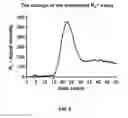 Fig. 07 - NOVEL MAGNETIC RESONANCE IMAGE TECHNIQUE FOR IMAGING AND EVALUATING COLLATERAL CIRCULATION