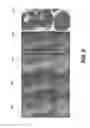 Fig. 12 - Detection of tooth condition using reflectance images with red and green fluorescence