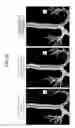 Fig. 10 - Medical image processing apparatus and medical image processing method