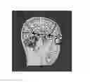 Fig. 01 - Medical image processing method and apparatus for determining plane of interest