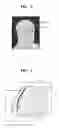 Fig. 03 - Medical image processing method and apparatus for determining plane of interest