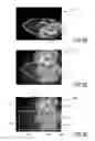 Fig. 06 - Device, system and method for automated detection of orientation and/or location of a person