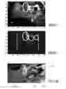 Fig. 08 - Device, system and method for automated detection of orientation and/or location of a person