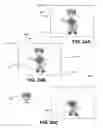 Fig. 16 - Divided Electronic Image Transmission System and Method
