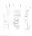 Fig. 06 - Method and apparatus for generation of 3D models with applications in dental restoration design