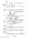 Fig. 06 - Failure determination device of hybrid vehicle and its failure determination method