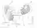 Fig. 01 - PATIENT ALARM SYSTEM AND DEVICE THEREFOR