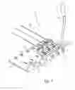 Fig. 06 - Stringed instrument system