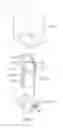 Fig. 11 - Varistor device