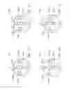 Fig. 16 - Circuit substrate and semiconductor package structure