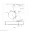 Fig. 07 - BRIDGING ARRANGEMENT, MICROELECTRONIC COMPONENT AND METHOD FOR MANUFACTURING A BRIDGING ARRANGEMENT