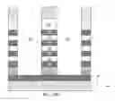 Fig. 18 - Concave word line and convex interlayer dielectric for protecting a read/write layer