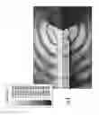 Fig. 08 - Method for dish reflector illumination via sub-reflector assembly with dielectric radiator portion
