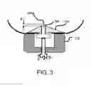 Fig. 04 - Corrosion Resistant Electrodes for Laser Chambers