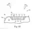 Fig. 07 - Ceramic feedthrough brazed to an implantable medical device housing
