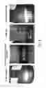 Fig. 08 - Efficient apparatus and method for inhibiting corrosion with discharge blocking features in a battery