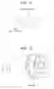 Fig. 09 - Structure for preventing scattering of magnet and retaining magnet for rotating electrical machine