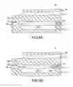 Fig. 11 - Bulk acoustic wave resonator comprising a ring