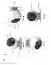 Fig. 02 - Fixed view magnetic camera