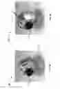 Fig. 06 - Fixed view magnetic camera