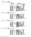 Fig. 16 - Solid-state imaging element having image signal overflow path