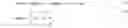 Fig. 02 - Method of sample adaptive offset processing for video coding
