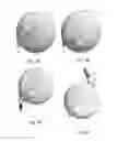 Fig. 03 - In-ear hearing device and broadcast streaming system