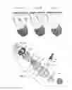 Fig. 08 - In-ear hearing device and broadcast streaming system