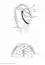Fig. 01 - Headphone