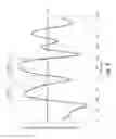 Fig. 06 - Triggering of transmission time interval bundling based on frequency selective channel quality information in a radio communication system
