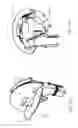 Fig. 14 - Seed meter