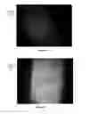 Fig. 10 - Systems and methods for using light energy to facilitate penetration of substances in plants