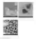 Fig. 01 - Antibacterial micro- and nanoparticles comprising a chlorhexidine salt, method of production and uses thereof