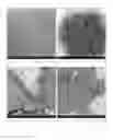 Fig. 02 - Antibacterial micro- and nanoparticles comprising a chlorhexidine salt, method of production and uses thereof