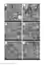 Fig. 15 - Antibacterial micro- and nanoparticles comprising a chlorhexidine salt, method of production and uses thereof