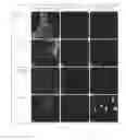 Fig. 24 - Antibacterial micro- and nanoparticles comprising a chlorhexidine salt, method of production and uses thereof