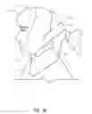 Fig. 04 - Supremely adjustable facial mask