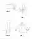 Fig. 04 - Glove