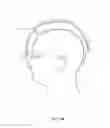Fig. 11 - PROTECTIVE HEADGEAR