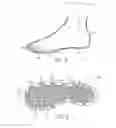Fig. 04 - Therapeutic shoe insert