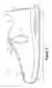 Fig. 03 - Method of manufacturing a contoured fluid-filled chamber with a tensile member
