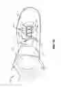 Fig. 04 - Easy access articles of footwear