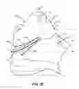 Fig. 06 - Easy access articles of footwear